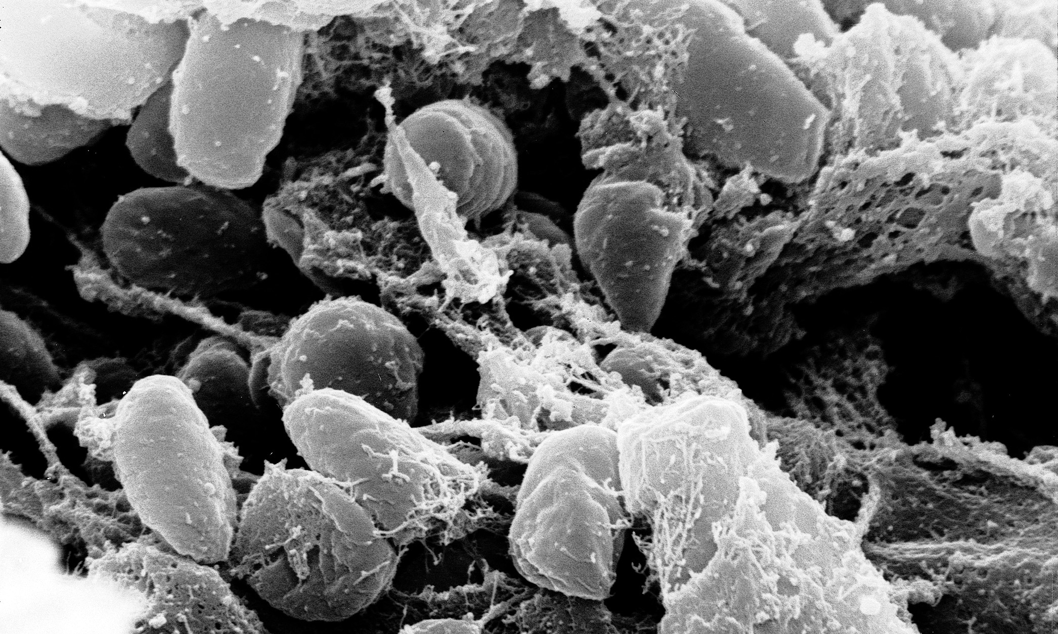 Yersinia pestis